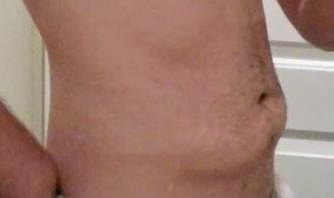 Abdomen