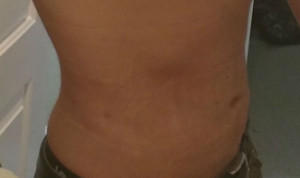 Abdomen
