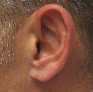 Ear Correction