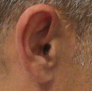 Ear Correction