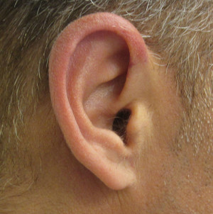 Ear Correction