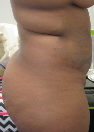 Bra Rolls